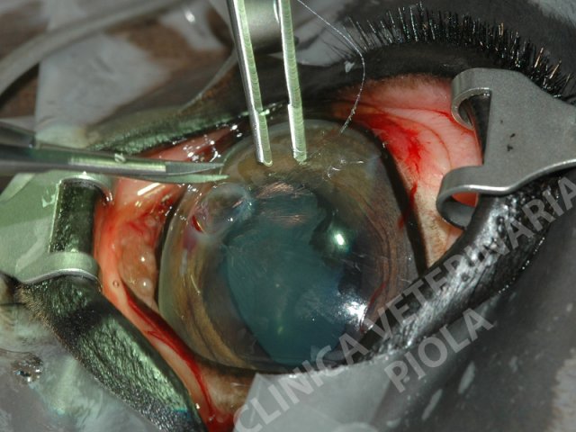 PK-Cheratoplastica penetrante